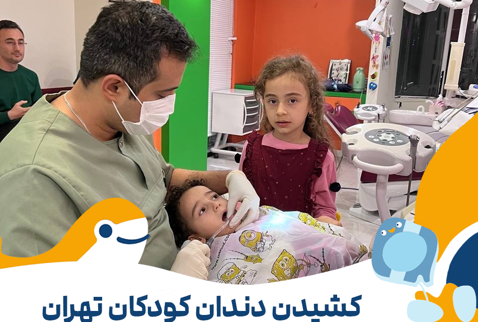 کشیدن دندان کودکان تهران