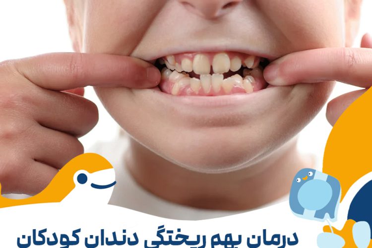 درمان بهم ریختگی دندان کودکان در تهران