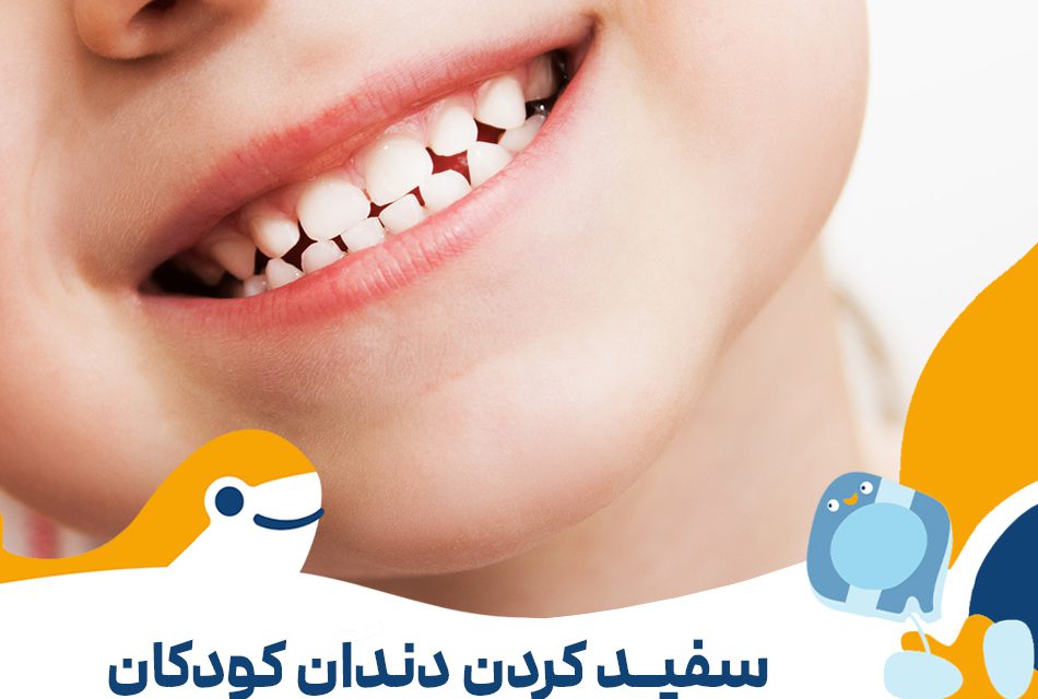 روش های سفید کردن دندان کودکان در خانه